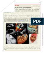 Abscess With Bioprosthetic Valve