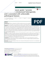 PTEN Loss in Gleason Grade 7 Prostate Tumors Exhibits Intratumoral Heterogeneity and Is Associated With Unfavorable Pathological Features