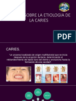 Teorías de La Caries