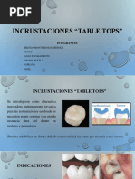 Incrustaciones Table Tops