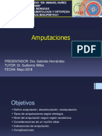 Amputaciones