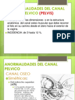 Anormalidades Del Canal Pelvico Pelvis