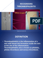 Teaching Slide Recognising Thrombophlebitis