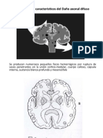 Lesion Axonal Difusa Imagenes