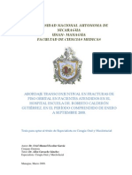 Abordaje Transconjuntiva