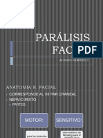 Paralisis Facial