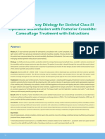 Probable Airway Etiology For Skeletal Class III Openbite Malocclusion With Posterior CrossbiteCamouflage Treatment With Extractions PDF