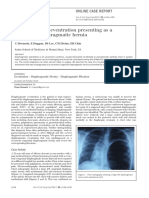 Diaphragmatic Eventration Presenting As A Recurrent Diaphragmatic Hernia