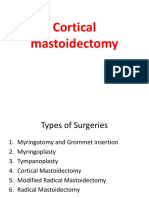 Cortical Mastoid Surgery