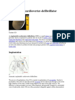 Implantable Cardioverter