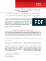 Fascioliasis: 3 Cases With Three Different Clinical Presentations