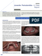 1603 - Juvenile Periodontitis 1603