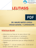 Tema 42 Colelitiasis DR Mateo