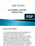 Vertebral Artery Dissection