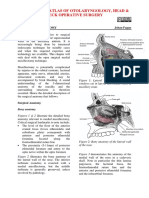 Medial Maxillectomy