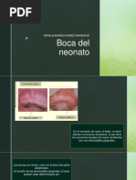 Boca Del Neonato