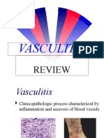 Vasculitis Review