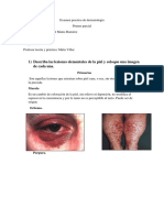 Examen Practica de Dermatología 