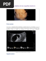 Ecografia Obstetrica