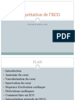 Interprétation de l'ECG: Zinebkarouchi