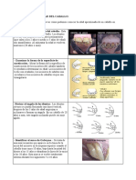 Ficha Dentadura y Altura