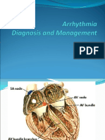 Arrhythmia Diagnosis and Management