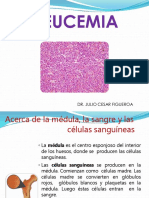 Leucemia