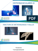 FX MTT y Hallux