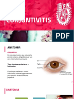 Conjuntivitis