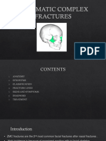 Zygomatic Complex Fractures