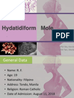 Hydatidiform Mole: PGI Sia, Kevin PGI Tan, Sheila