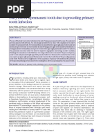 Early Loss of A Permanent Tooth Due To Preceding Primary Tooth Infection