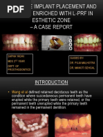 Immediate Implant Placement and Loading Enriched With L-PRF in Esthetic Zone - A Case Report