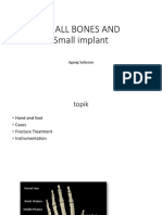 Small Bones and Small Implant: Agung Sutiyoso