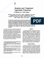 Classification and Treatment of Zygomatic Fractures