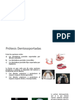 Prótesis Dentosoportadas