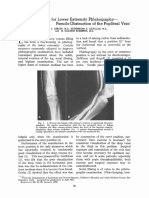 A Simple Method For Lower Extremity Phlebography-Pseudo-Obstruction of The Popliteal Vein!