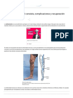 Safenectomía - en Qué Consiste, Complicaciones y Recuperación - Lifeder