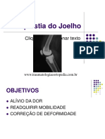 Artroplastia de Joelho