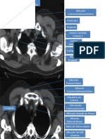 Anatomia Radiológica TORAX-1