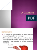 La Gastritis