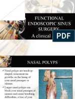 Functional Endoscopic Sinus Surgery: A Clinical Abstract