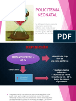 Policitemia Neonatal