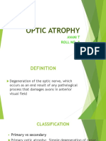 Optic Atrophy