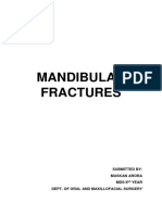 Mandibular Fractures