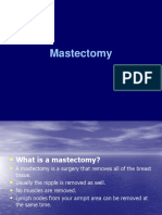 Mastectomy