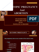 Ectopic Pregnancy and Abortion: DR - Shamim Rima MBBS, Dmu, FCGP M.PHL Radiology & Imagimg