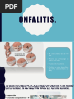 Onfalitis