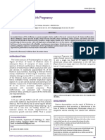 Bicornuate Uterus With Pregnancy