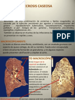 Necrosis Caseosa PDF